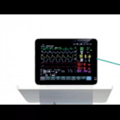 Moniteur multi-paramètres pour notre système d'anesthésie à l'isuflorane sur roulettes