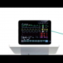 Moniteur multi-paramètres pour notre système d'anesthésie à l'isuflorane sur roulettes