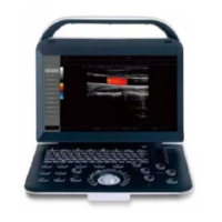 Doppler couleur portable Doppler couleur portable