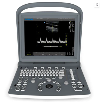 Echographe N&B CHISON ECO2 avec 1 ou 2 connecteurs de sonde