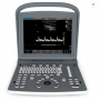 Echographe N&B CHISON ECO2 avec 1 ou 2 connecteurs de sonde