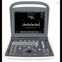 Echographe N&B CHISON ECO2 avec 1 ou 2 connecteurs de sonde Echographe N&B CHISON ECO2 avec 1 ou 2 connecteurs de sonde