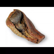 Cavité thoracique canine côté droit