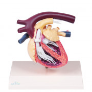 Coeur de chien avec dirofilariose