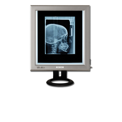 Négatoscopes de bureau ultra fins LED