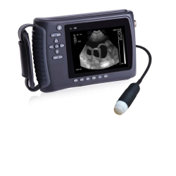 Scanner à ultrasons portable
