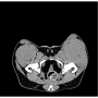 /simulateurs-de-soins-veterinaires/fantome-pelvien-de-chien-pour-radiographie-et-scanner-p-4003941.1-600x600.png