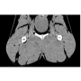 /simulateurs-de-soins-veterinaires/fantome-pelvien-de-chien-pour-radiographie-et-scanner-p-4003941.3-600x600.jpg